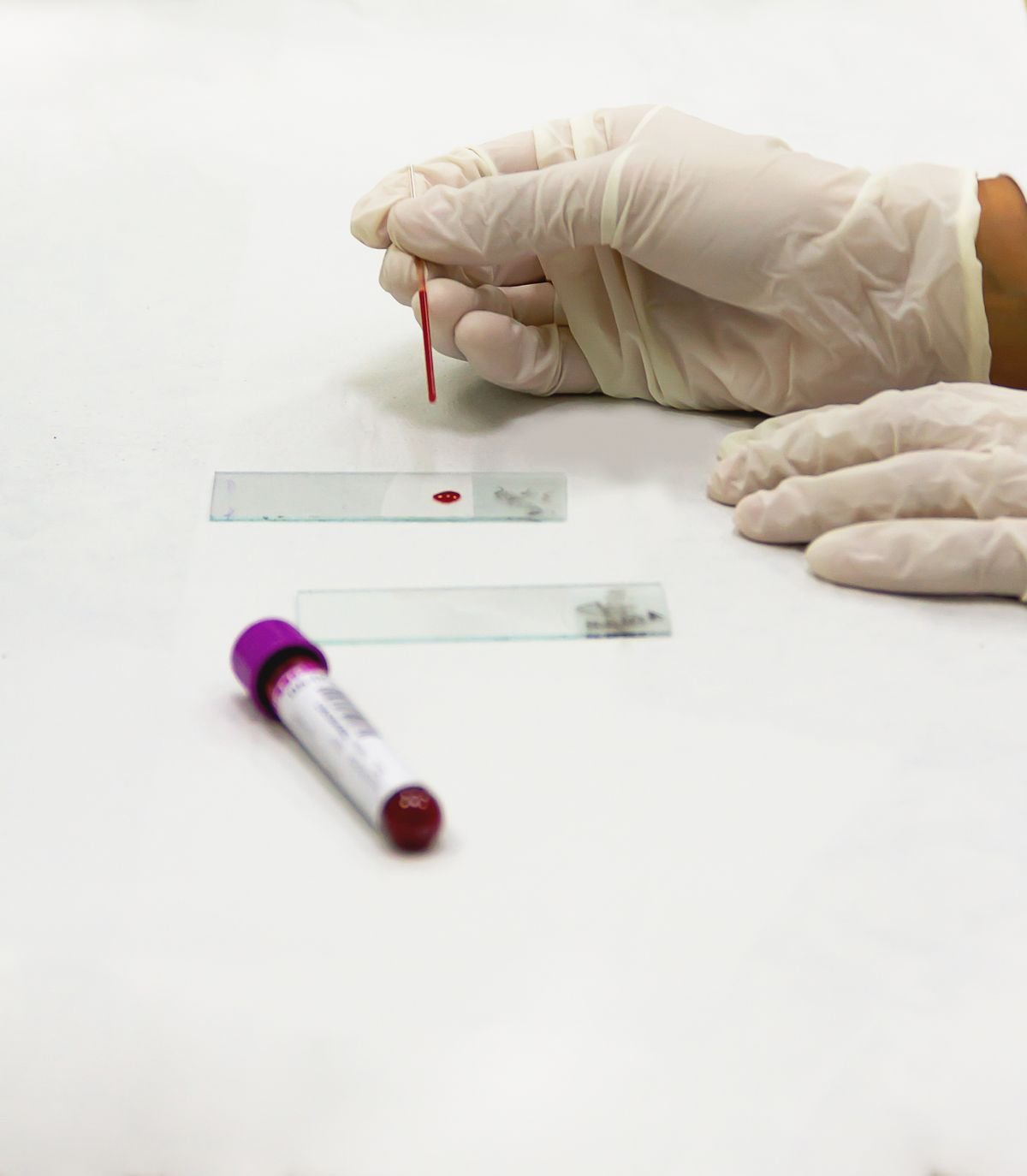 Muestra de sangre y material de laboratorio para análisis clínicos, imagen ilustrativa de banco de imágenes