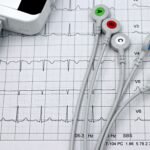 Electrodos de un sistema de monitorización cardíaca sobre un registro electrocardiográfico (imagen ilustrativa de banco de imágenes de libre uso comercial, Pexels, autora Marta Branco)