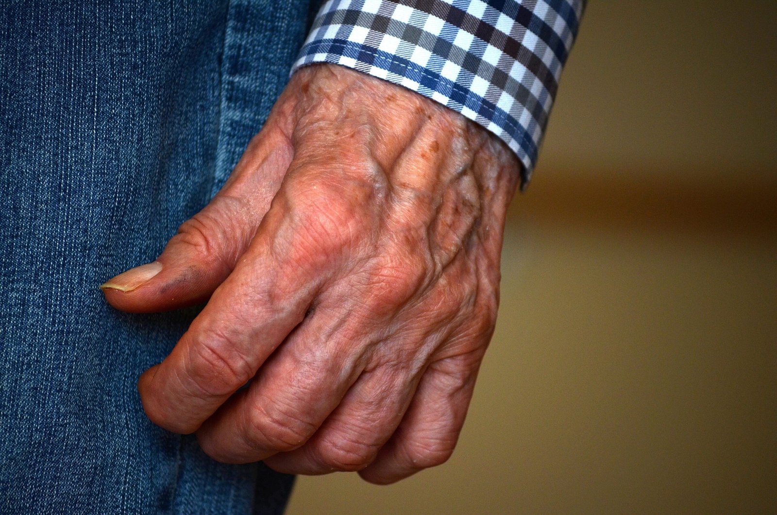 Mano de una persona mayor, imagen ilustrativa (foto de stock Pexels, sin relación con un centro concreto)